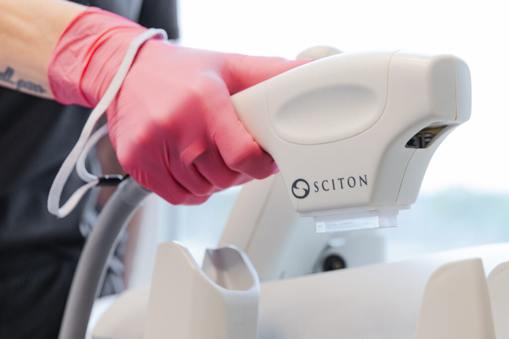 Dermatologist wearing gloves holds a laser for rosacea in Prosper as part of a treatment plan to calm facial redness