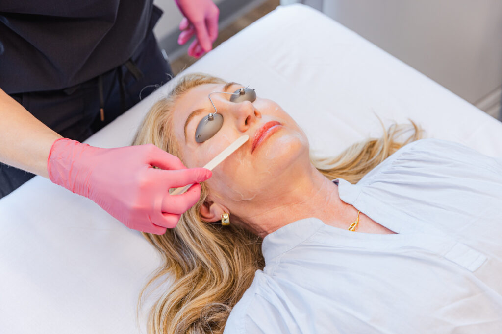 Woman lays on back with protective eyewear while provider prepares her skin for a treatment to calm redness recommended by a rosacea dermatologist in Frisco