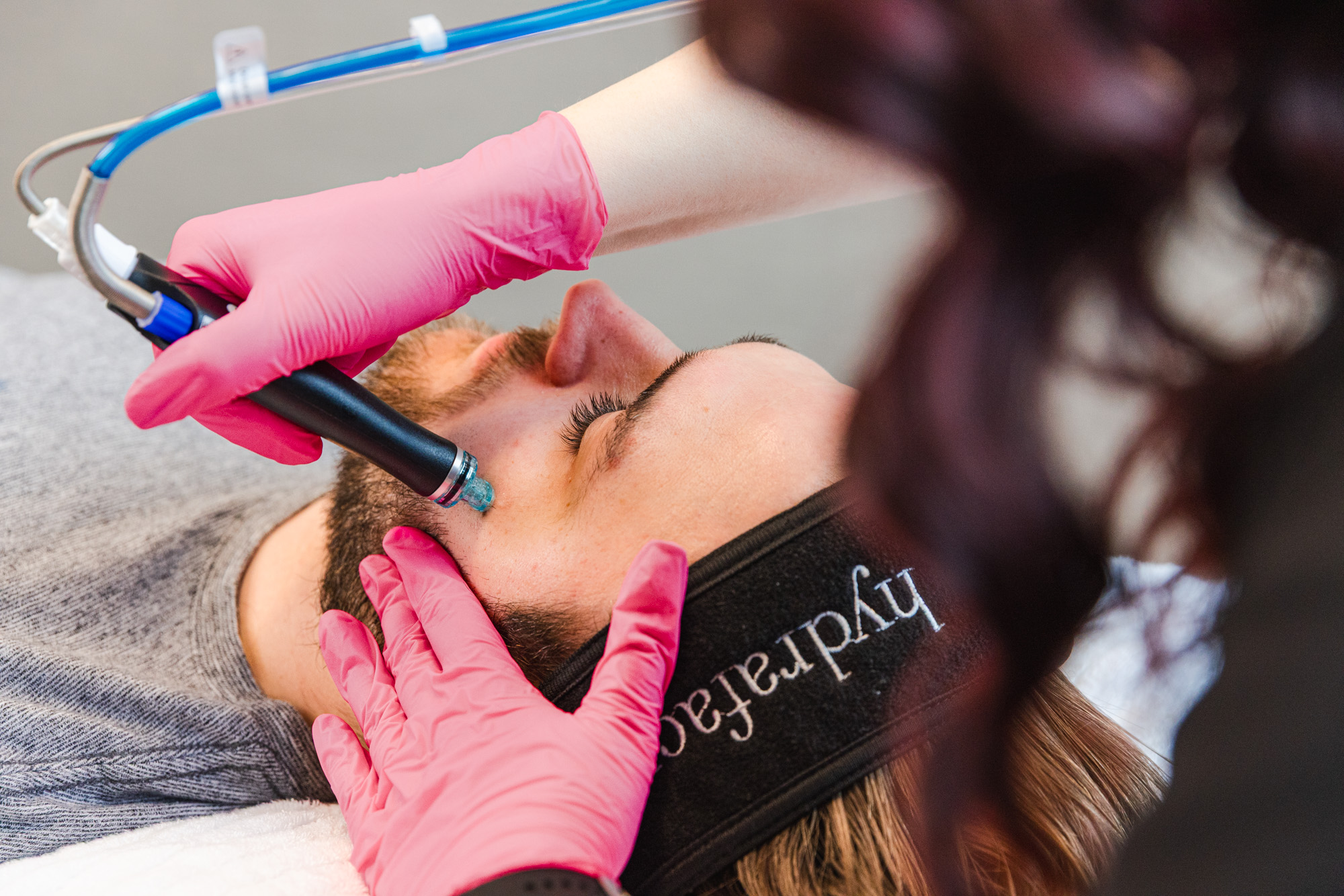 Young man has eyes closed as provider exfoliates his skin with Hydrafacial, one of many effective options for hormonal pimple treatment in Plano.