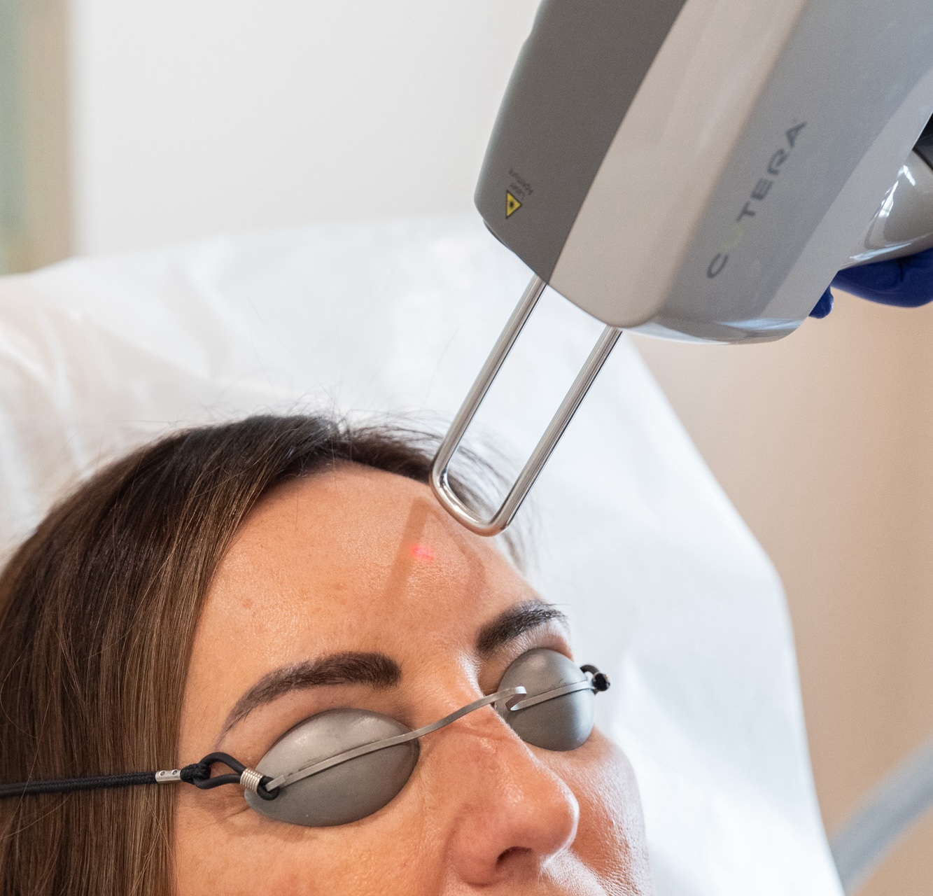 Patient wears protective goggles for a rosacea laser treatment in Flower Mound to reduce reddness on her face
