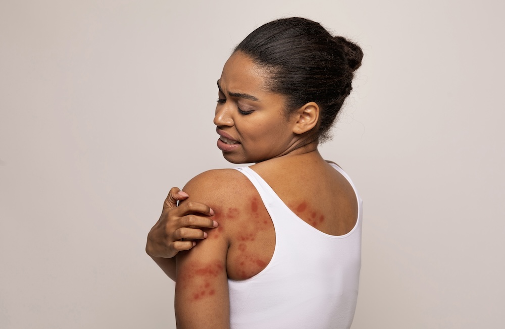 Woman turned to her side and rubbing at a persistent, itching rash that has spread from her arm to her back. She is considering visiting a skin treatment clinic in Plano for relief.