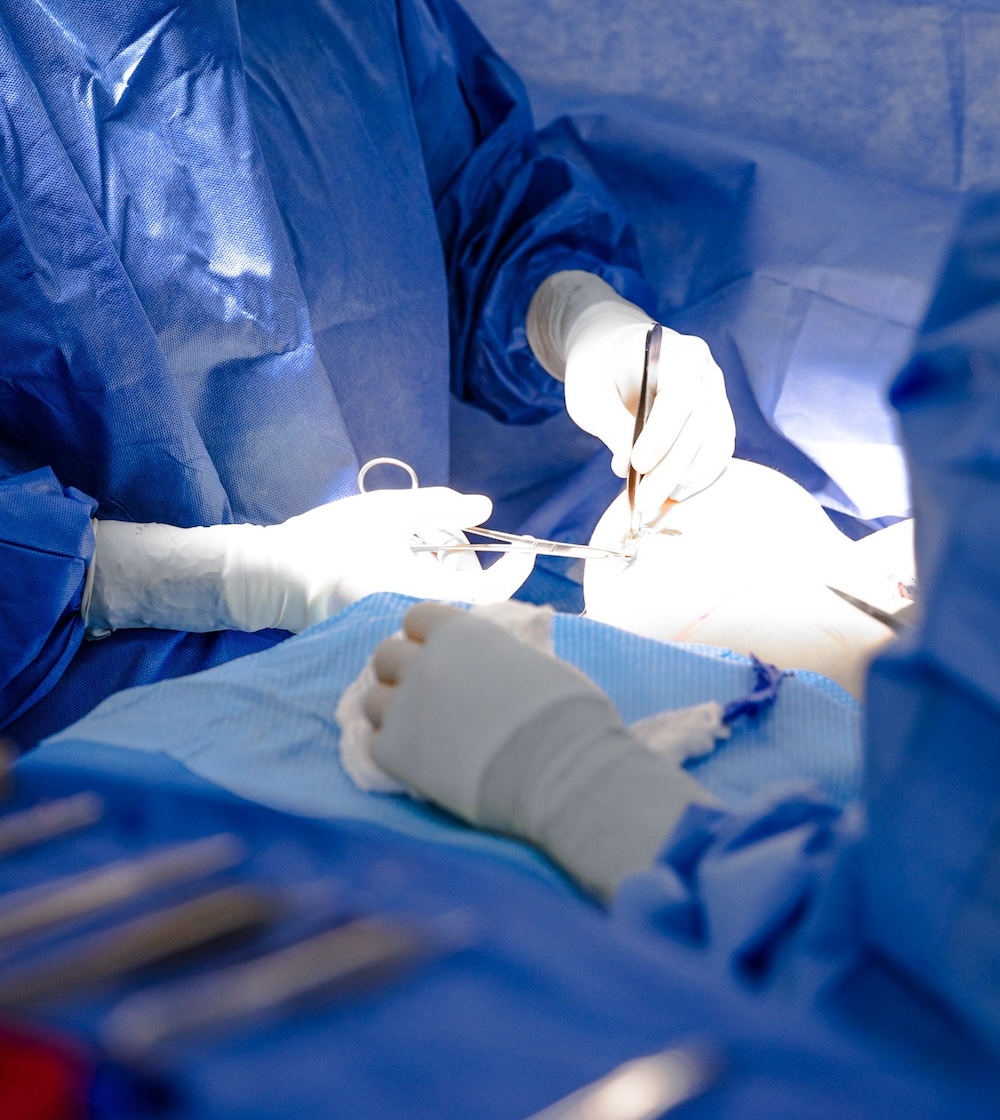 Two plastic surgeons wearing gloves and surgical scrubs and performing a breast reduction in Plano.